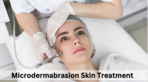 Revitalize Your Skin with Microdermabrasion Skin Treatment in Australia